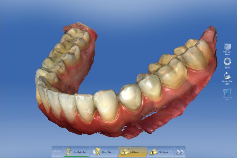 cerec_ortho_